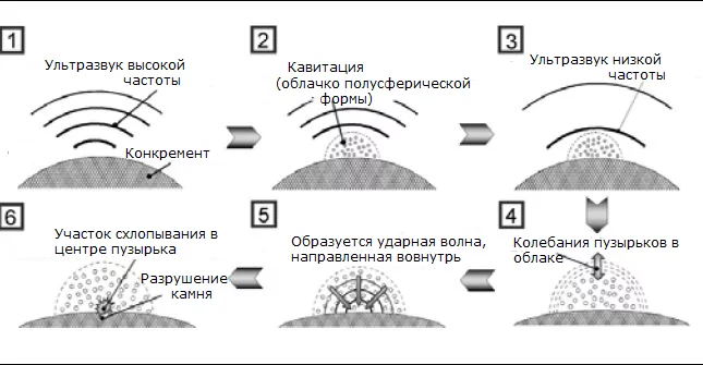mekhanizm-deystviya-ultrazvuka
