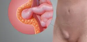 Пахова грижа