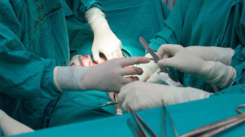 Клініка Біляка Нефроптоз у вагітних: особливості, ризики та методи лікування фото 6 Клініка Біляка Нефроптоз у вагітних: особливості, ризики та методи лікування фото 5