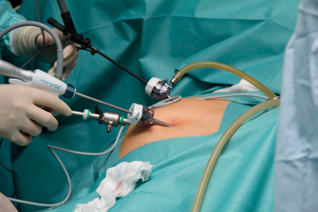 Клініка Біляка Міфи про рак простати: що правда, а що вигадка? фото 8 Клініка Біляка Міфи про рак простати: що правда, а що вигадка? фото 7