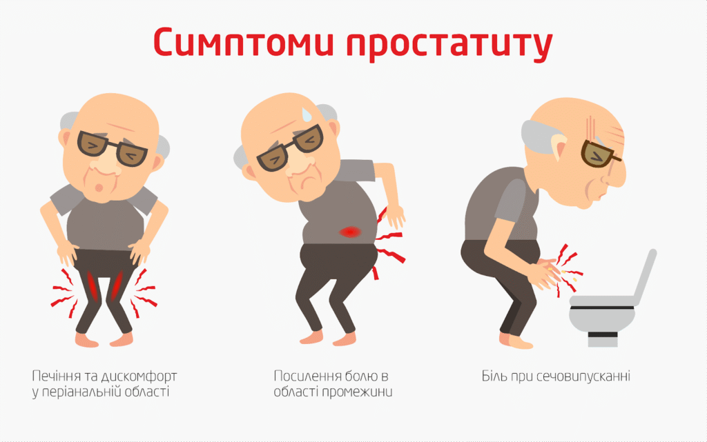Клініка Біляка Хронічний простатит: як розпізнати та лікувати сучасними методами фото 5