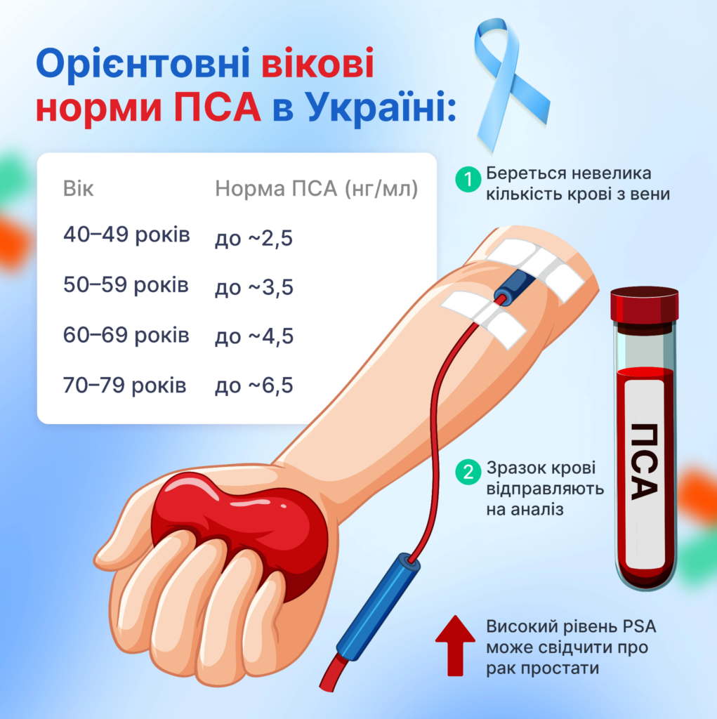Аналіз ПСА: як правильно підготуватися, щоб не отримати хибно високий результат фото