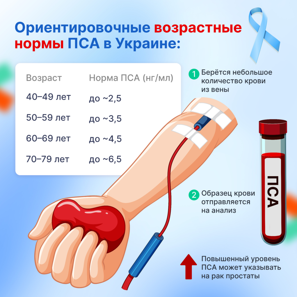 Анализ ПСА: как правильно подготовиться, чтобы не получить ошибочно высокий результат фото
